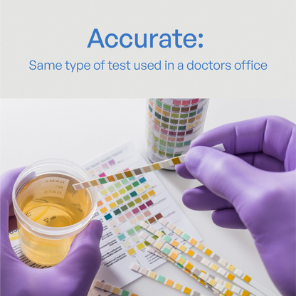 UTIVA Urinary Tract Infection (UTI) Diagnostic Test Strips - ActivKare